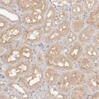 Immunohistochemical staining of human kidney shows moderate cytoplasmic positivity in cells in tubules.