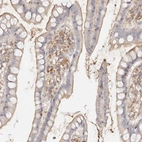Immunohistochemical staining of human small intestine shows moderate cytoplasmic positivity in lymphoid cells.