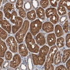 Immunohistochemical staining of human kidney shows strong cytoplasmic positivity in cells in tubules.