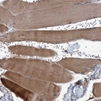 Immunohistochemical staining of human skeletal muscle shows moderate cytoplasmic positivity in myocytes.