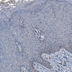 Immunohistochemical staining of human skin shows no positivity in squamous epithelial cells.
