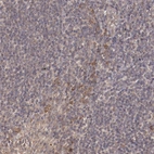 Immunohistochemical staining of human lymphoid tissues shows moderate cytoplasmic positivity in squamous epithelial cells.