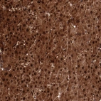 Immunohistochemical staining of human liver shows strong cytoplasmic and nuclear positivity in hepatocytes.