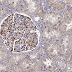 Immunohistochemical staining of human kidney shows strong cytoplasmic positivity in cells in glomeruli.
