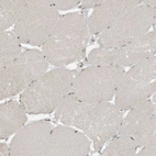 Immunohistochemical staining of human skeletal muscle shows weak nuclear positivity in myocytes.