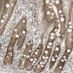 Immunohistochemical staining of human duodenum shows strong nuclear positivity in glandular cells with additional cytoplasmic positivity.