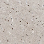 Immunohistochemical staining of human cerebral cortex shows moderate nuclear positivity in neuronal cells.