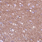 Immunohistochemical staining of human cerebral cortex shows strong cytoplasmic positivity in neuronal processes.