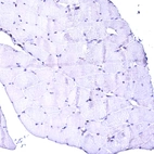 Immunohistochemical staining of human skeletal muscle shows no positivity in myocytes as expected.