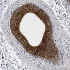 Immunohistochemical staining of human epididymis shows strong membranous-cytoplasmic positivity in glandular cells.