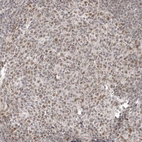 Immunohistochemical staining of human lymphoid tissues shows moderate nuclear positivity in germinal center cells.