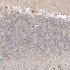 Immunohistochemical staining of human cerebellum shows strong nuclear positivity in Purkinje cells.