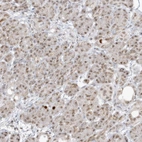 Immunohistochemical staining of human pancreas shows weak nuclear positivity in exocrine glandular cells.
