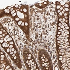 Immunohistochemical staining of human rectum shows moderate cytoplasmic-membranous positivity in glandular cells and lymphoid cells.