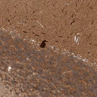 Immunohistochemical staining of human cerebellum shows strong cytoplasmic positivity in Purkinje cells and molecular layer cells.