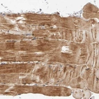 Immunohistochemical staining of human skeletal muscle shows weak to moderate cytoplasmic positivity in myocytes.