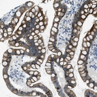 Immunohistochemical staining of human rectum shows strong cytoplasmic-membranous positivity in glandular cells.