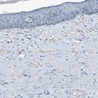 Immunohistochemical staining of human skin shows no positivity in squamous epithelial cells.