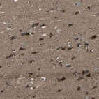 Immunohistochemical staining of human cerebral cortex shows strong cytoplasmic-membranous positivity in neuronal cells.