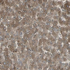 Immunohistochemical staining of human liver shows moderate cytoplasmic positivity in hepatocytes.