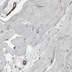 Immunohistochemical staining of human skeletal muscle shows strong cytoplasmic-membranous positivity in endothelial cells.
