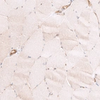 Immunohistochemical staining of human skeletal muscle shows very weak cytoplasmic positivity in myocytes.