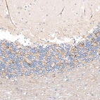 Immunohistochemical staining of human cerebellum shows strong membranous positivity in glial cells.