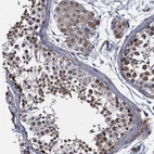 Immunohistochemical staining of human testis shows strong nuclear positivity in cells in seminiferous ducts with additional cytoplasmic positivity in Leydig cells.