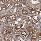 Immunohistochemical staining of human kidney shows moderate cytoplasmic positivity in cells in tubules.