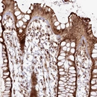 Immunohistochemical staining of human rectum shows strong cytoplasmic positivity in glandular cells with additional nuclear positivity. Also, moderate nuclear positivity in lymphoid cells.
