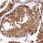 Immunohistochemical staining of human testis shows strong cytoplasmic positivity in cells in seminiferous ducts with additional nuclear positivity.