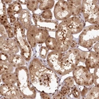 Immunohistochemical staining of human kidney shows moderate cytoplasmic positivity in cells in tubules with additional nuclear positivity.