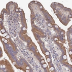 Immunohistochemical staining of human duodenum shows moderate membranous-cytoplasmic positivity in glandular cells.