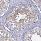 Immunohistochemical staining of human testis shows moderate membranous positivity in subset of cells in seminiferous ducts.