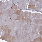 Immunohistochemical staining of human skeletal muscle shows moderate membranous-cytoplasmic positivity in subset of cells in myocytes