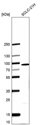 Western blot analysis in human cell line SCLC-21H.