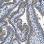 Immunohistochemical staining of human fallopian tube shows moderate positivity in nuclear membrane in subset glandular cells with additional cytoplasmic positivity.