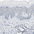 Immunohistochemical staining of human skin shows no positivity in squamous epithelial cells.