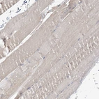 Immunohistochemical staining of human skeletal muscle shows weak cytoplasmic positivity in myocytes.