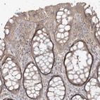 Immunohistochemical staining of human gastrointestinal shows moderate membranous-cytoplasmic positivity in glandular cells.