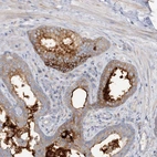 Immunohistochemical staining of human prostate shows moderate membranous positivity in glandular cells.