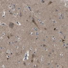 Immunohistochemical staining of human cerebral cortex shows moderate cytoplasmic positivity in neuronal cells.