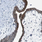 Immunohistochemical staining of human placenta shows moderate cytoplasmic positivity in trophoblastic cells.