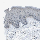 Immunohistochemical staining of human skin shows no positivity in squamous epithelial cells.