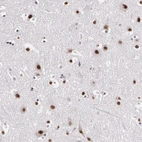 Immunohistochemical staining of human cerebral cortex shows strong nuclear positivity in neuronal cells.