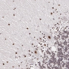 Immunohistochemical staining of human cerebellum shows strong nuclear positivity in Purkinje cells and molecular and granular layer cells.