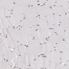 Immunohistochemical staining of human skeletal muscle shows moderate nuclear positivity in myocytes.