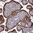Immunohistochemical staining of human placenta shows strong cytoplasmic-membranous positivity in trophoblastic cells.