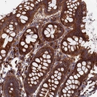 Immunohistochemical staining of human colon shows strong cytoplasmic-membranous positivity in glandular cells.