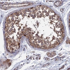 Immunohistochemical staining of human testis shows moderate cytoplasmic-membranous positivity in cells in seminiferous ducts.